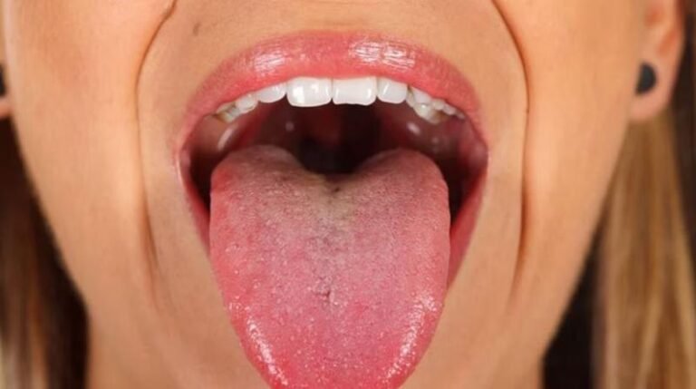 बी12 की कमी से कमजोर होती नर्व्स और ब्रेन हेल्थ— अनदेखा करना पड़ सकता है भारी